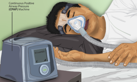 Tratamiento con CPAP y sus problemas.