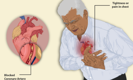 La apnea del sueño sin síntomas diurnos se asocia a mayor riesgo de enfermedad cardiovascular.